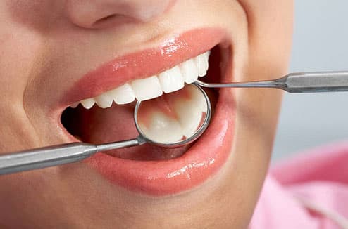 Restorative Dentistry