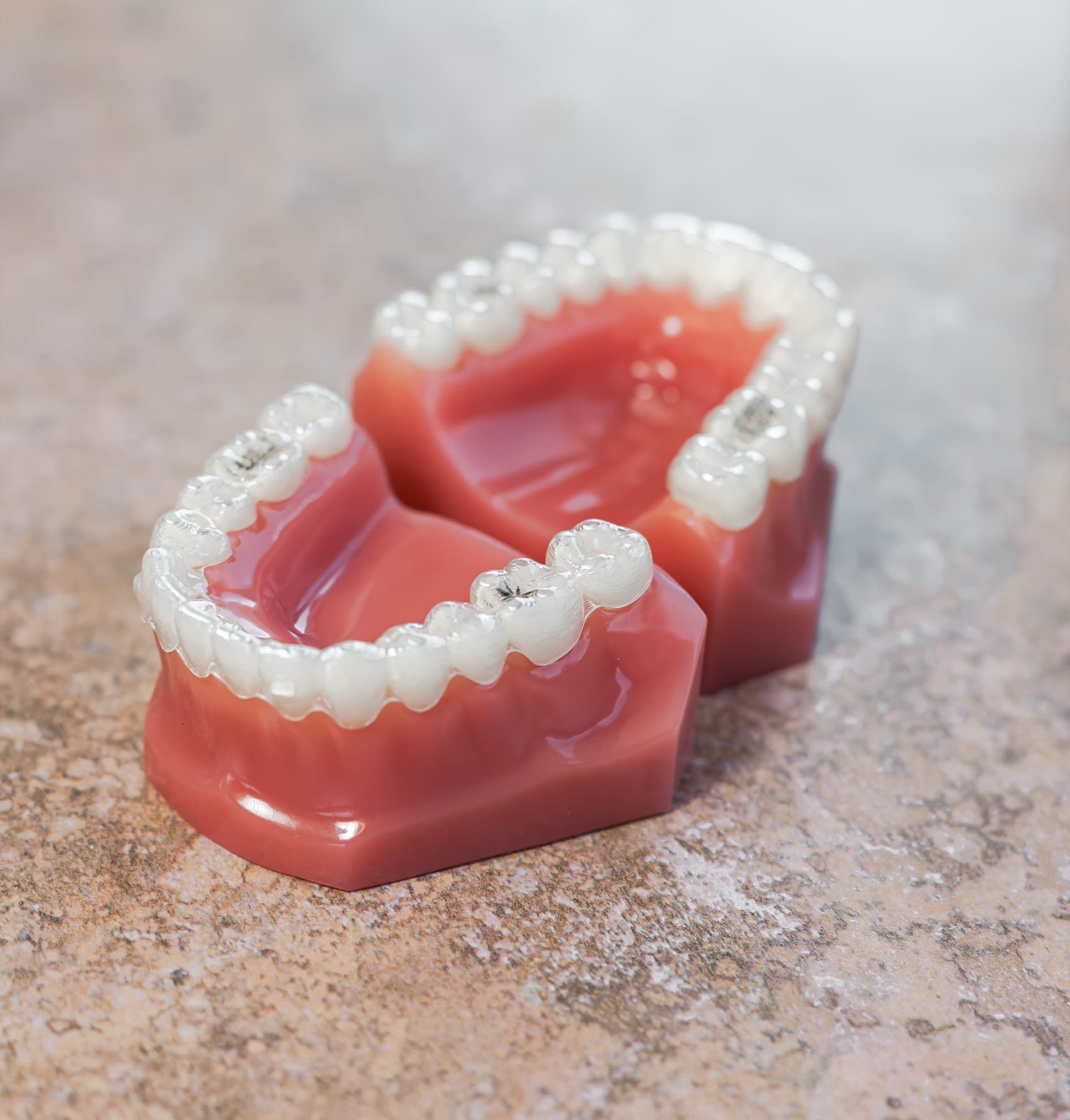 Clear aligners