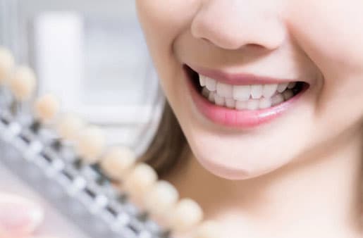 Professional teeth whitening