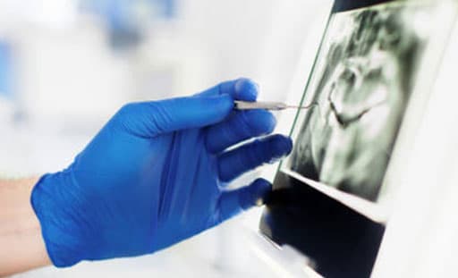 Digital X-Rays
